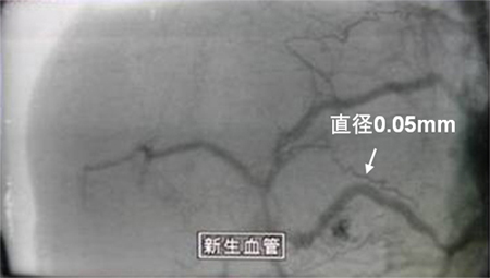 超高感度HARPカメラの放送以外への応用例マウスのガンにできた新生血管（東海大医学部ほか）